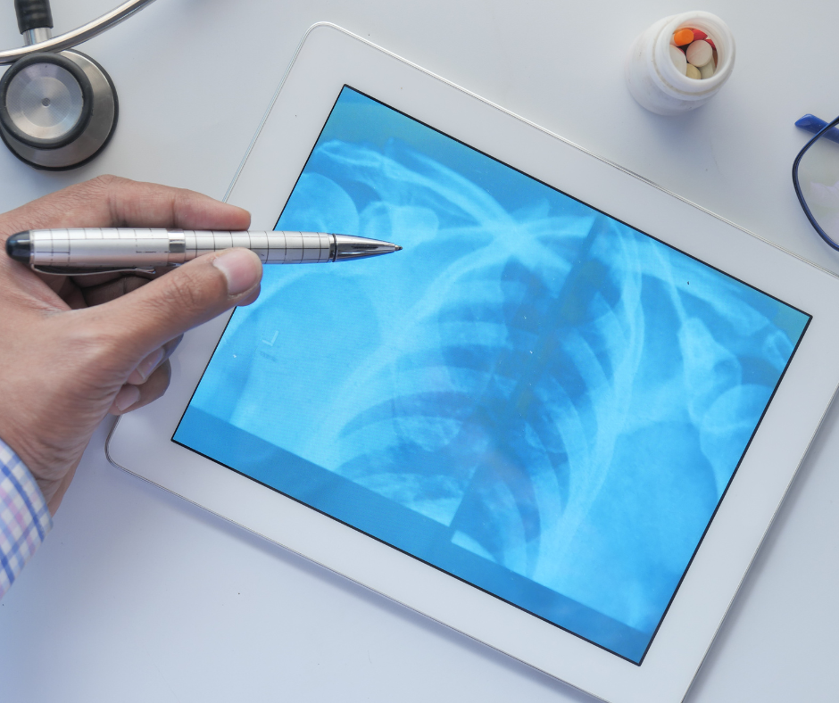 Doctor analyzing X-ray on tablet with pen.