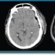 PET, CT, MRI brain scans comparison image.