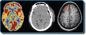 PET, CT, MRI brain scans comparison image.